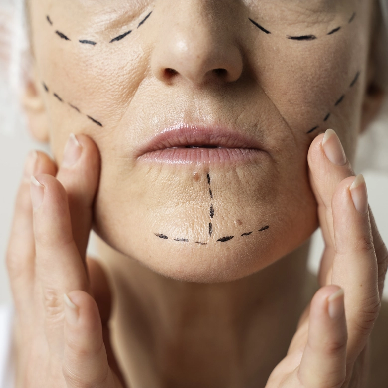 کانتورینگ صورت