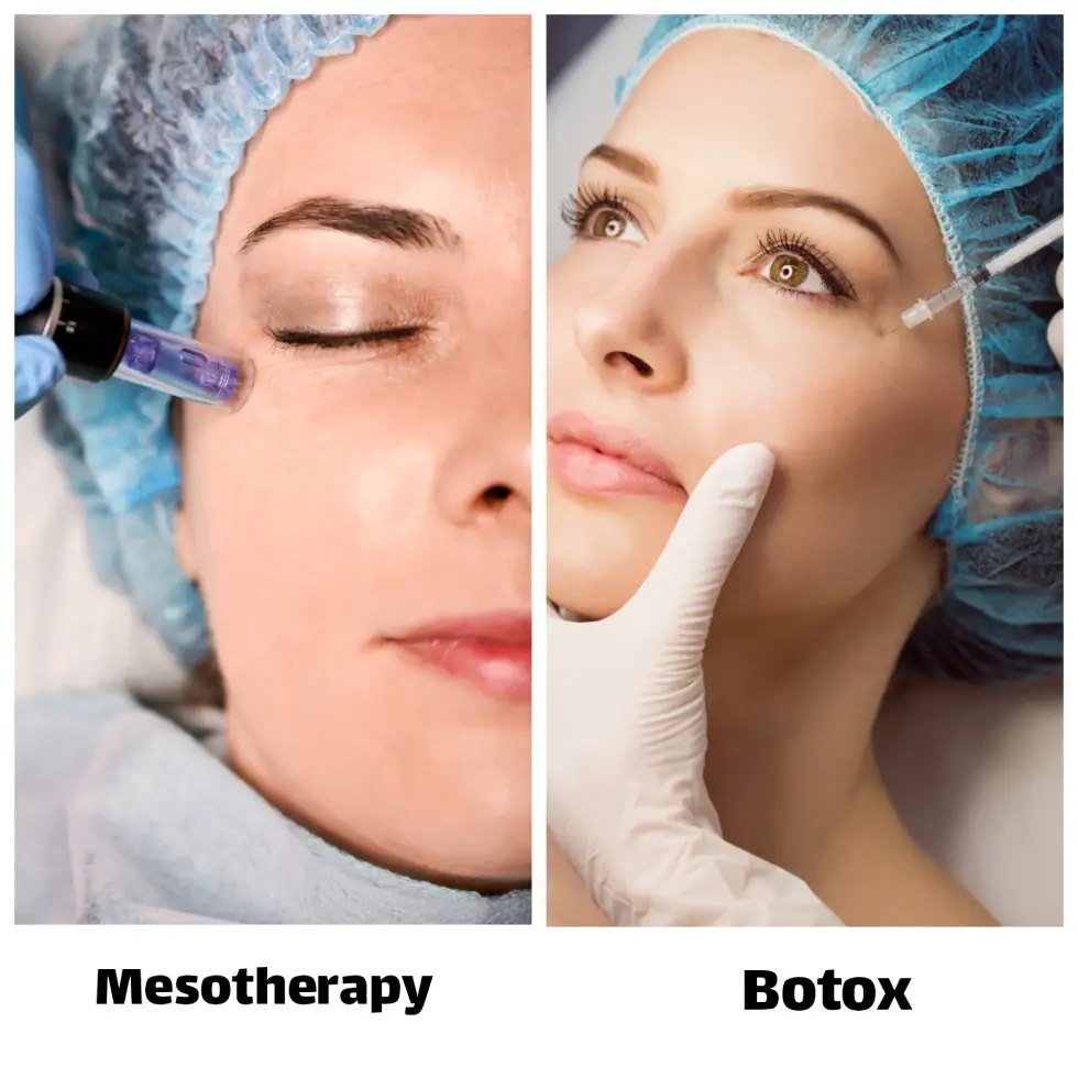 تفاوت مزوتراپی و بوتاکس